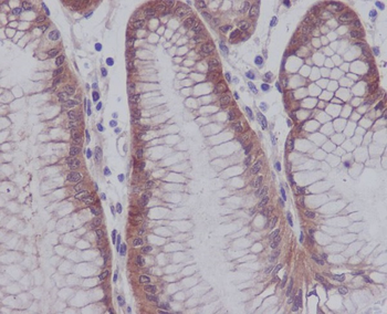 YAP1 (Phospho-Ser127) Rabbit mAb Antibody