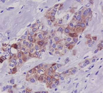 Tau (Phospho-Ser396) Rabbit mAb Antibody