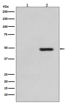 Tau (Phospho-Thr231) Rabbit mAb Antibody