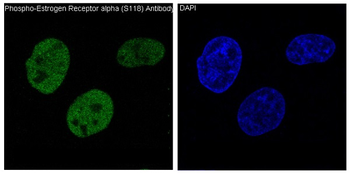 ER alpha (Phospho-Ser118) Rabbit mAb Antibody