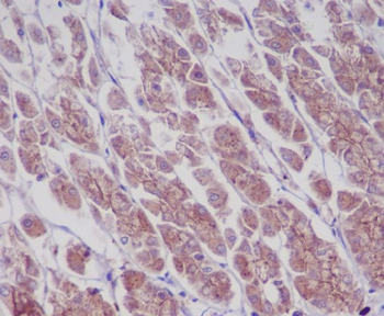 EGFR (Phospho-Tyr1173) Rabbit mAb [KD Validated] Antibody