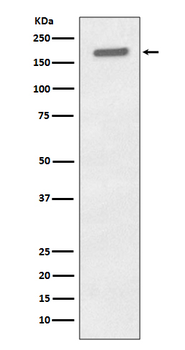 EGFR (Phospho-Tyr1173) Rabbit mAb [KD Validated] Antibody