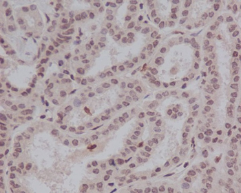 Stat5 (Phospho-Tyr694) Rabbit Monoclonal Antibody