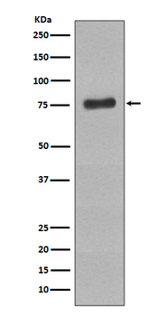 BTK (Phospho-Tyr223) Rabbit mAb Antibody