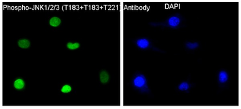 JNK1/2/3 (Phospho-Thr183+Thr183+Thr221) Rabbit mAb Antibody