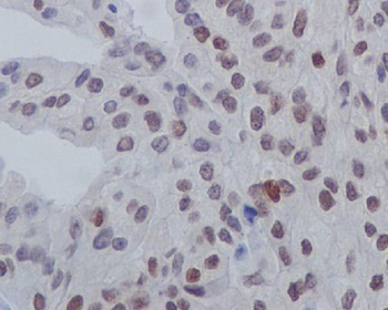 GATA3 (Phospho-Ser308) Rabbit mAb [KD Validated] Antibody
