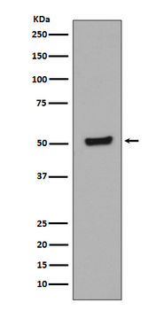 p53 (Phospho-Thr55) Rabbit mAb Antibody