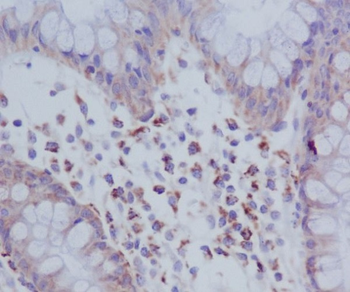 PKR (Phospho-Thr446) Rabbit mAb Antibody