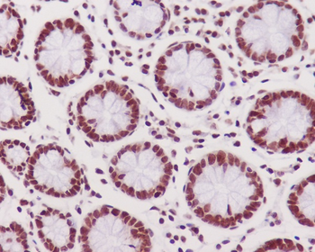 DNA PKcs (Phospho-Ser2056) Rabbit mAb [KD Validated] Antibody