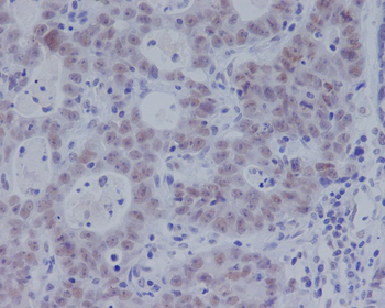 Smad3 (Phospho-Ser423/Ser425) Rabbit mAb Antibody