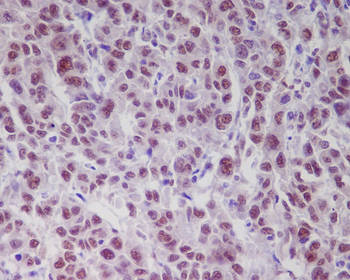 ATM (Phospho-Ser1981) Rabbit mAb Antibody