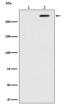 ATM (Phospho-Ser1981) Rabbit mAb Antibody
