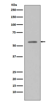 p53 (Phospho-Ser33) Rabbit mAb Antibody