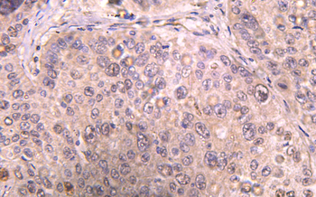 Recombinant IL6 Rabbit mAb(G12) Antibody