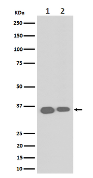 ELOVL5 Rabbit Monoclonal Antibody