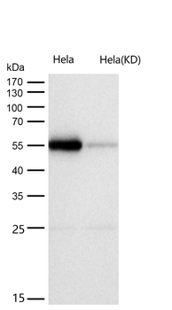 PRD Rabbit mAb [KD Validated]