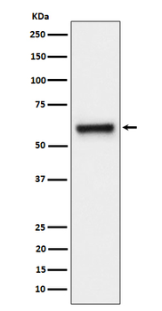 FPGS Rabbit Monoclonal Antibody