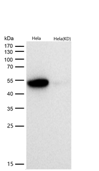 AAMP Rabbit mAb [KD Validated] Antibody