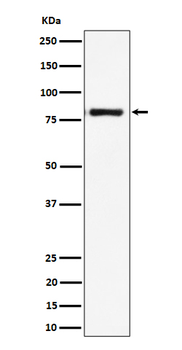LTK Rabbit mAb Antibody