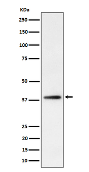 FDPS Rabbit Monoclonal Antibody