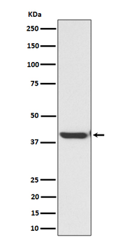 ENDOGL1 / ENGL Rabbit mAb [KD Validated] Antibody