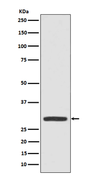 Galectin 3 Rabbit mAb [KD Validated]