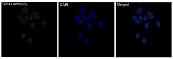 TDP43 Rabbit mAb [KD Validated] Antibody