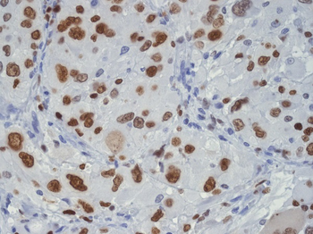 TDP43 Rabbit mAb [KD Validated] Antibody