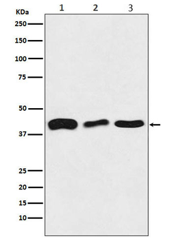 TDP43 Rabbit mAb [KD Validated] Antibody