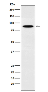EWSR1 Rabbit Monoclonal Antibody