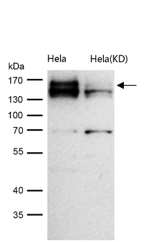 CLSTN1 Rabbit mAb [KD Validated] Antibody