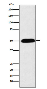 CYP27A1 Rabbit mAb Antibody