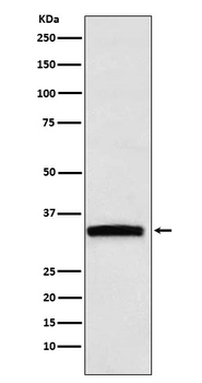 GDF15 Rabbit mAb Antibody