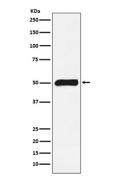 FKBP51 Rabbit Monoclonal Antibody