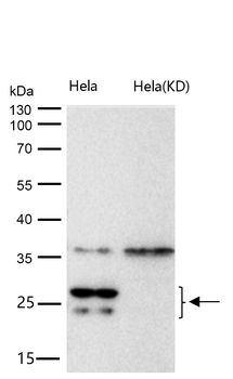 COMT Rabbit Monoclonal Antibody