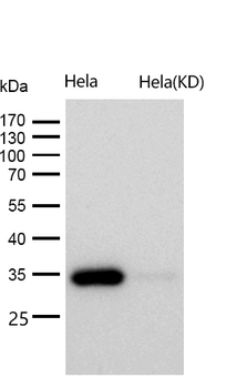 STUB1 Rabbit mAb [KD Validated] Antibody