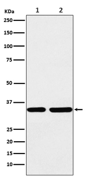 STUB1 Rabbit mAb [KD Validated] Antibody