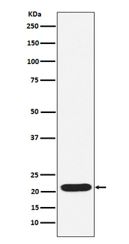 SOCS2 Rabbit mAb Antibody