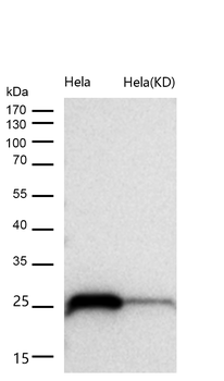 Casein Kinase 2 beta Rabbit Monoclonal Antibody