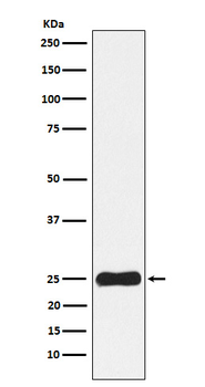 Casein Kinase 2 beta Rabbit Monoclonal Antibody