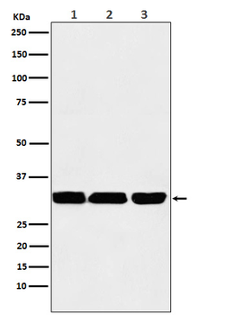 p53 DINP1 Rabbit mAb Antibody