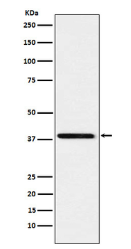 SAE1 Rabbit Monoclonal Antibody