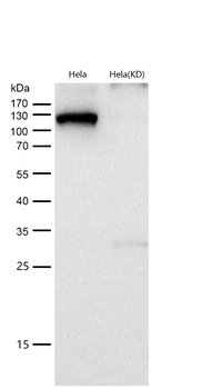 HAUSP / USP7 Rabbit mAb [KD Validated] Antibody