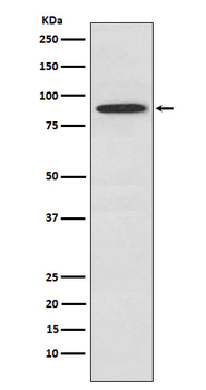 SAE2/UBA2 Rabbit Monoclonal Antibody