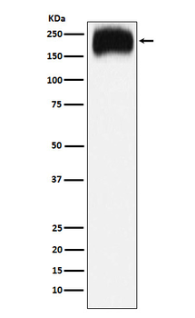 Niemann Pick C1 Rabbit Monoclonal Antibody