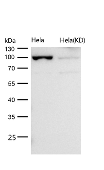 USP13 Rabbit mAb [KD Validated] Antibody