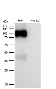 ApoER2 Rabbit Monoclonal Antibody