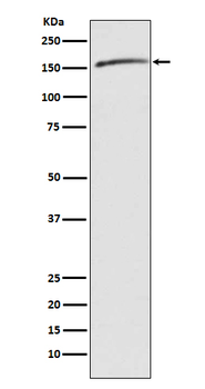 Drosha Rabbit mAb Antibody