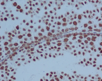 PARP Rabbit mAb Antibody