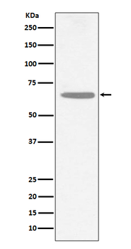 CHAT Rabbit Monoclonal Antibody